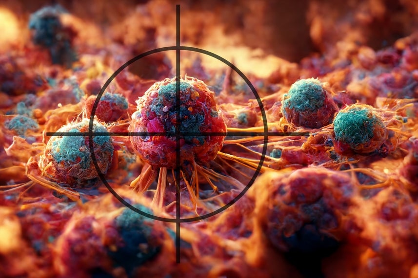 EXCLUSIVE: GT Biopharma Advances Relapsed Blood Cancer Therapy Trial To Cohort 2 After Promising Early Safety Results - GT Biopharma (NASDAQ:GTBP)