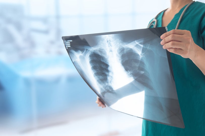 Summit Therapeutics' Closely-Watched Lung Cancer Study Of Ivonescimab Misses Overall Survival Endpoint - Summit Therapeutics (NASDAQ:SMMT)